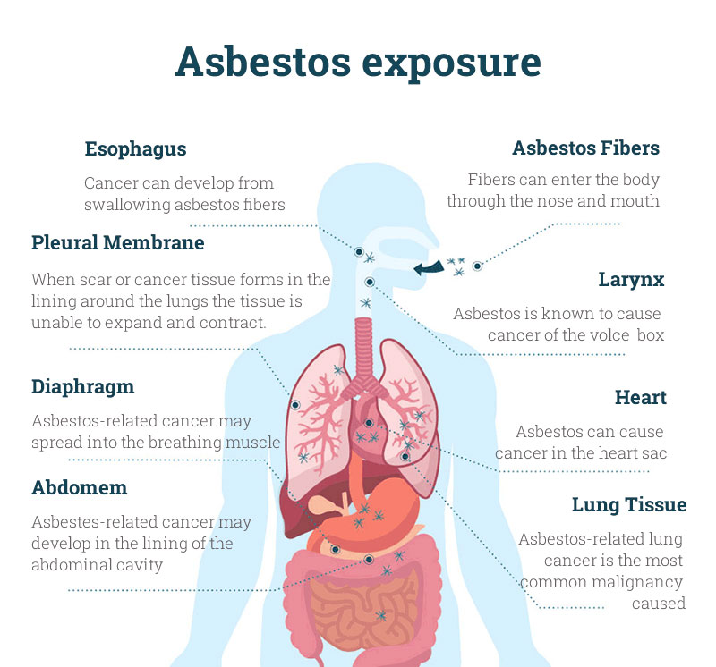 Asbestos exposure cause some diseases