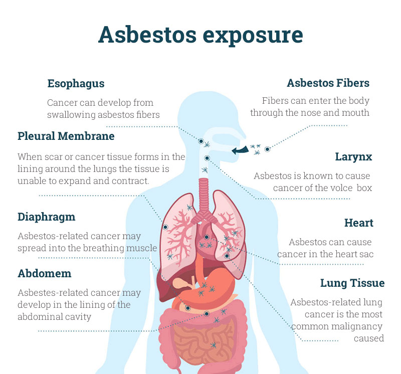 التعرض للأسبستوس يسبب بعض الأمراض